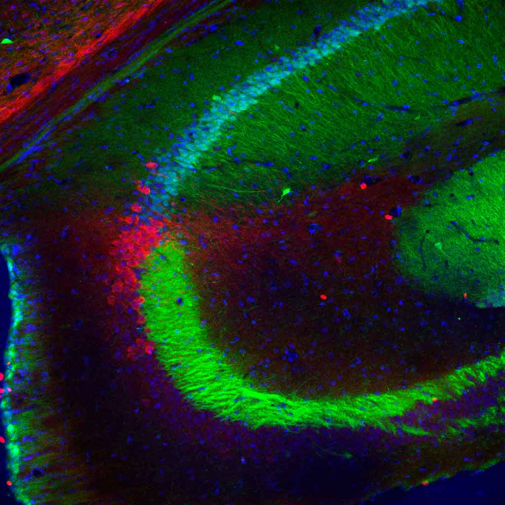 hippocampal-regions-1